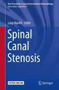 New Procedures in Spinal Interventional Neuroradiology