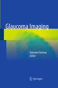 Glaucoma Imaging