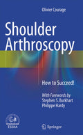 Shoulder Arthroscopy