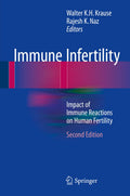 Immune Infertility