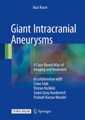 Giant Intracranial Aneurysms