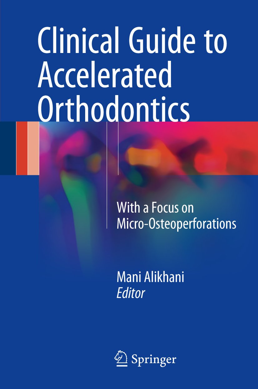 Clinical Guide to Accelerated Orthodontics