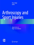 Arthroscopy and Sport Injuries