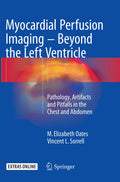 Myocardial Perfusion Imaging - Beyond the Left Ventricle