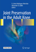 Joint Preservation in the Adult Knee