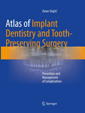 Atlas of Implant Dentistry and Tooth-Preserving Surgery