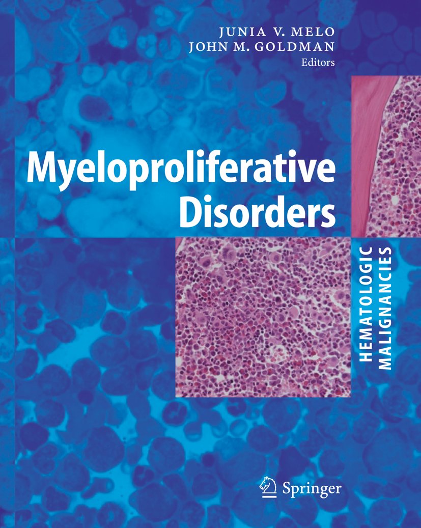Hematologic Malignancies