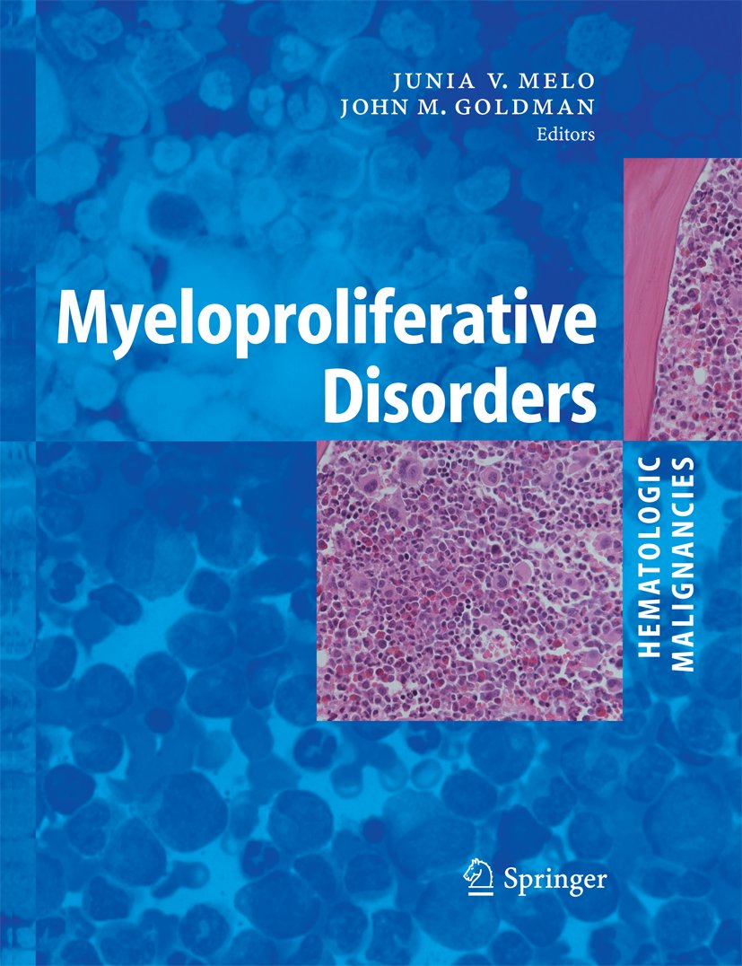 Hematologic Malignancies