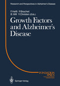 Research and Perspectives in Alzheimer's Disease