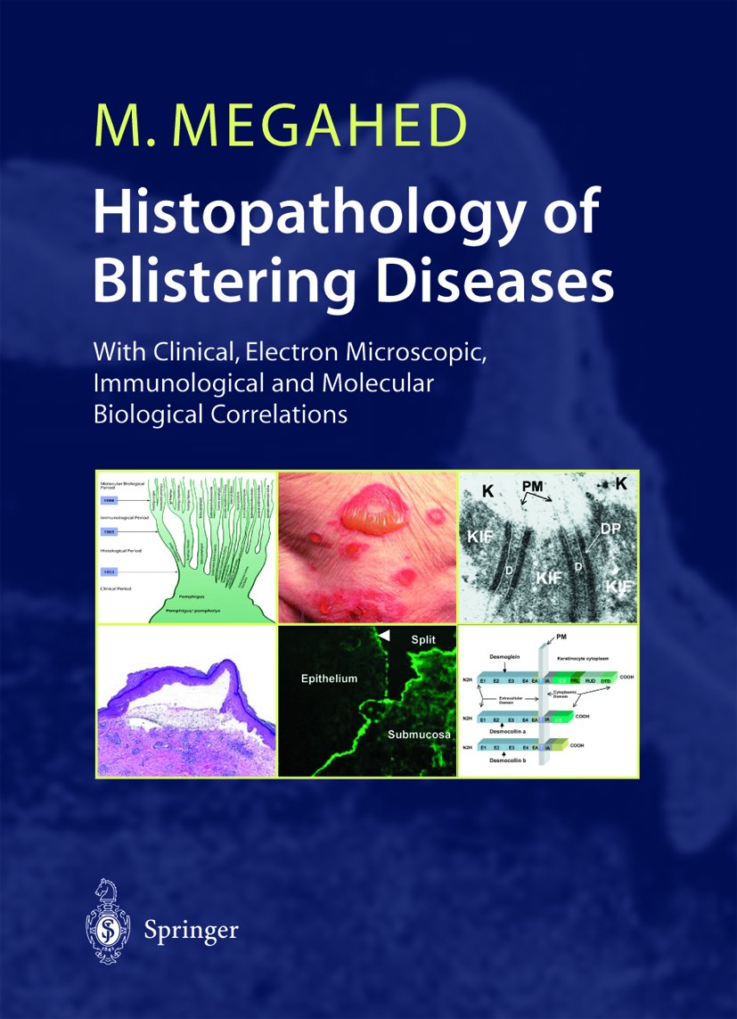 Histopathology of Blistering Diseases