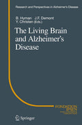 Research and Perspectives in Alzheimer's Disease