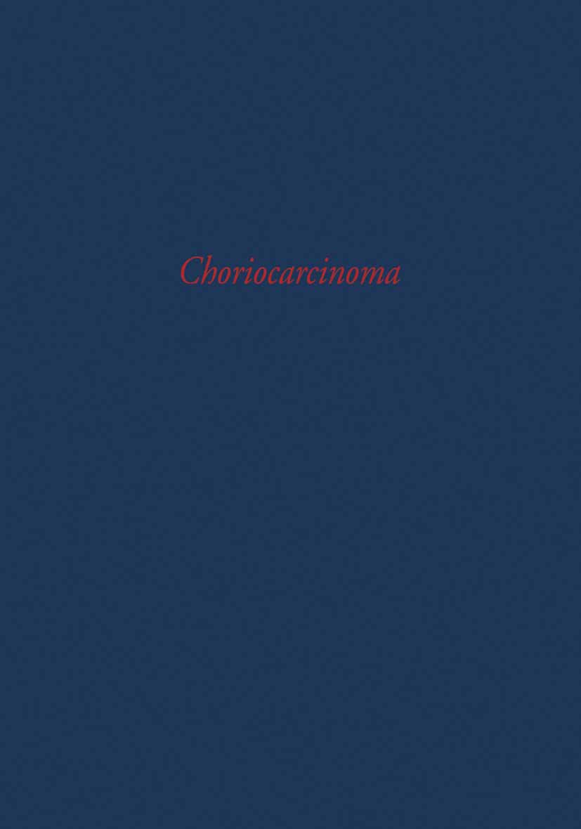 Choriocarcinoma