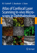 Atlas of Confocal Laser Scanning In-vivo Microscopy in Ophthalmology