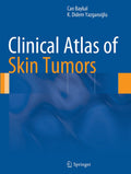 Clinical Atlas of Skin Tumors