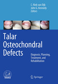 Talar Osteochondral Defects