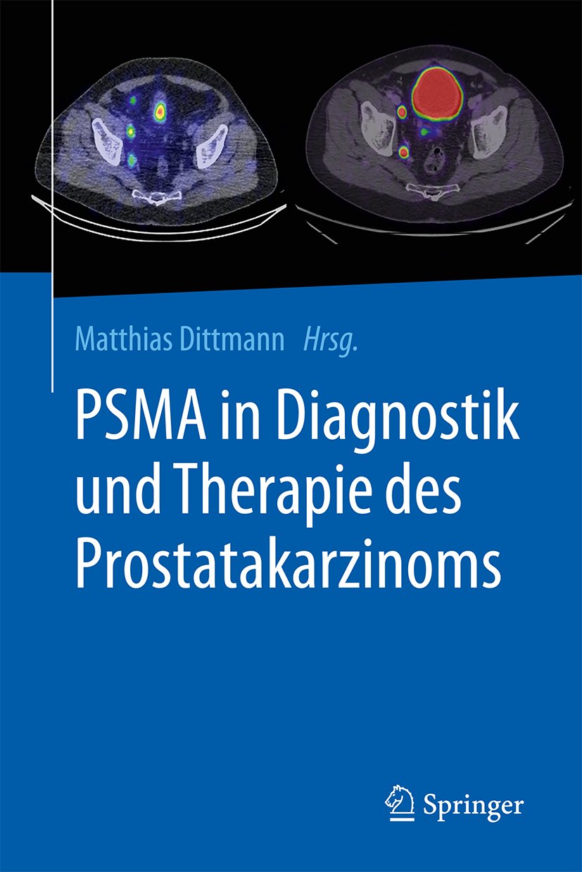 PSMA in Diagnostik und Therapie des Prostatakarzinoms