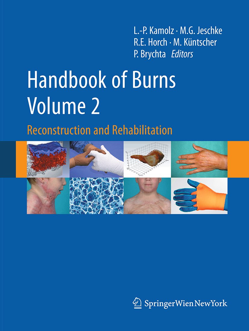 Handbook of Burns Volume 2