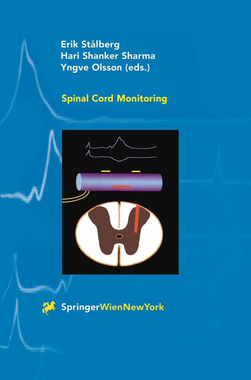 Spinal Cord Monitoring
