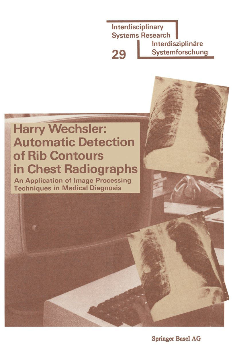 Automatic Detection of Rib Contours in Chest Radiographs