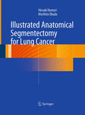 Illustrated Anatomical Segmentectomy for Lung Cancer