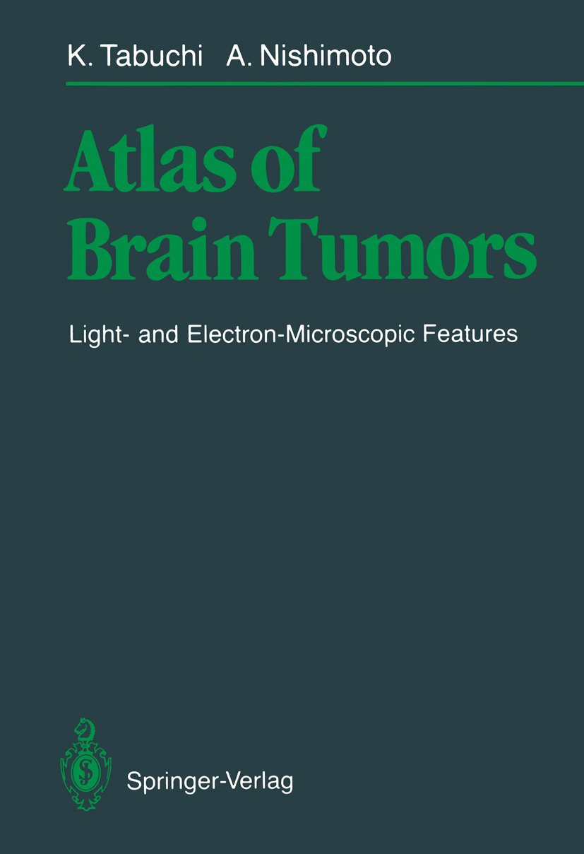 Atlas of Brain Tumors