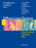Diffuse Lung Diseases