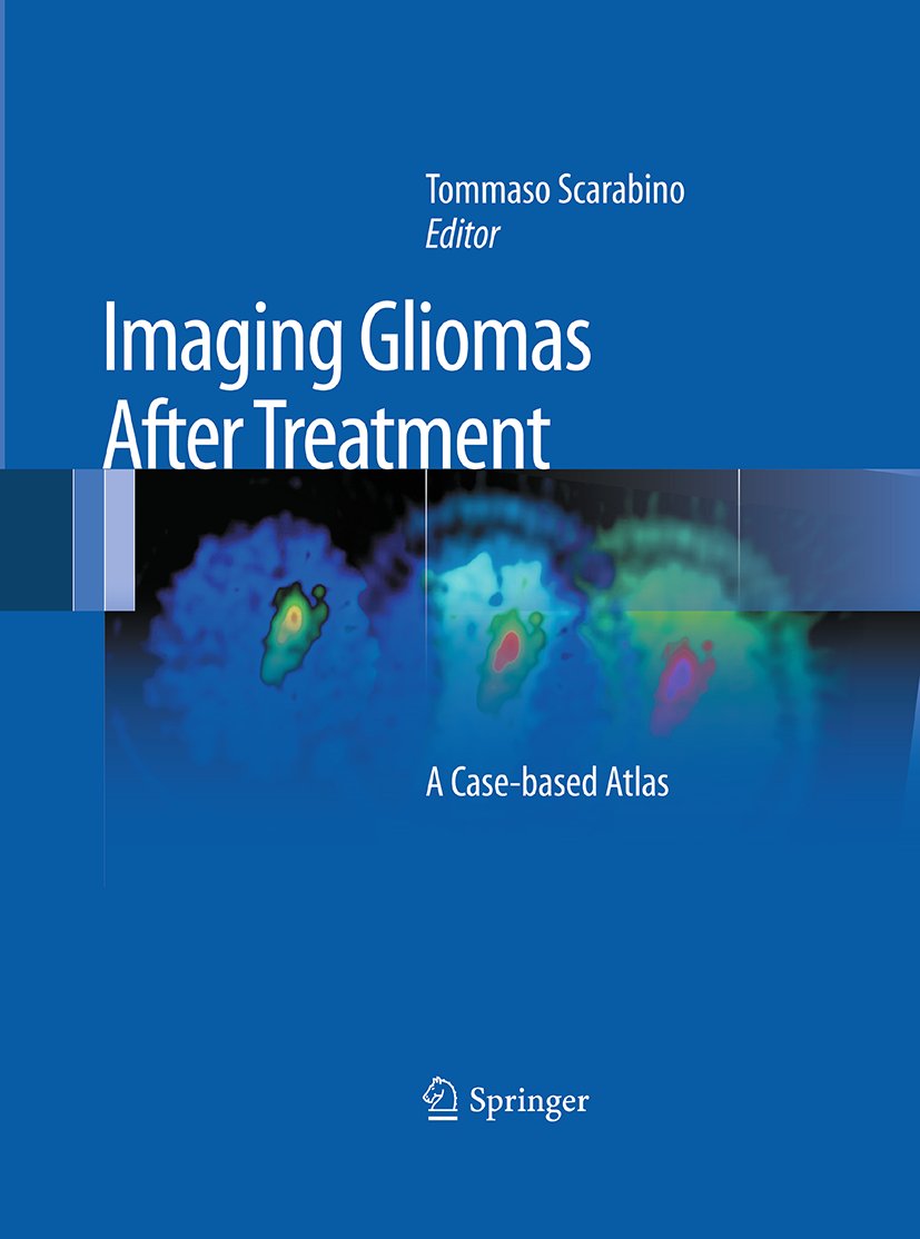 Imaging Gliomas After Treatment
