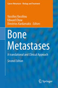Bone Metastases