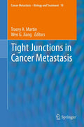 Cancer Metastasis - Biology and Treatment
