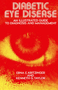Diabetic Eye Disease