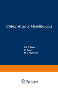 Colour Atlas of Mesothelioma