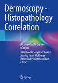 Dermoscopy - Histopathology Correlation