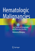 Hematologic Malignancies
