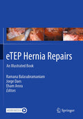 eTEP Hernia Repairs
