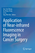 Application of Near-infrared Fluorescence Imaging in Cancer Surgery