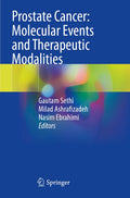 Prostate Cancer: Molecular Events and Therapeutic Modalities