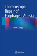 Thoracoscopic Repair of Esophageal Atresia