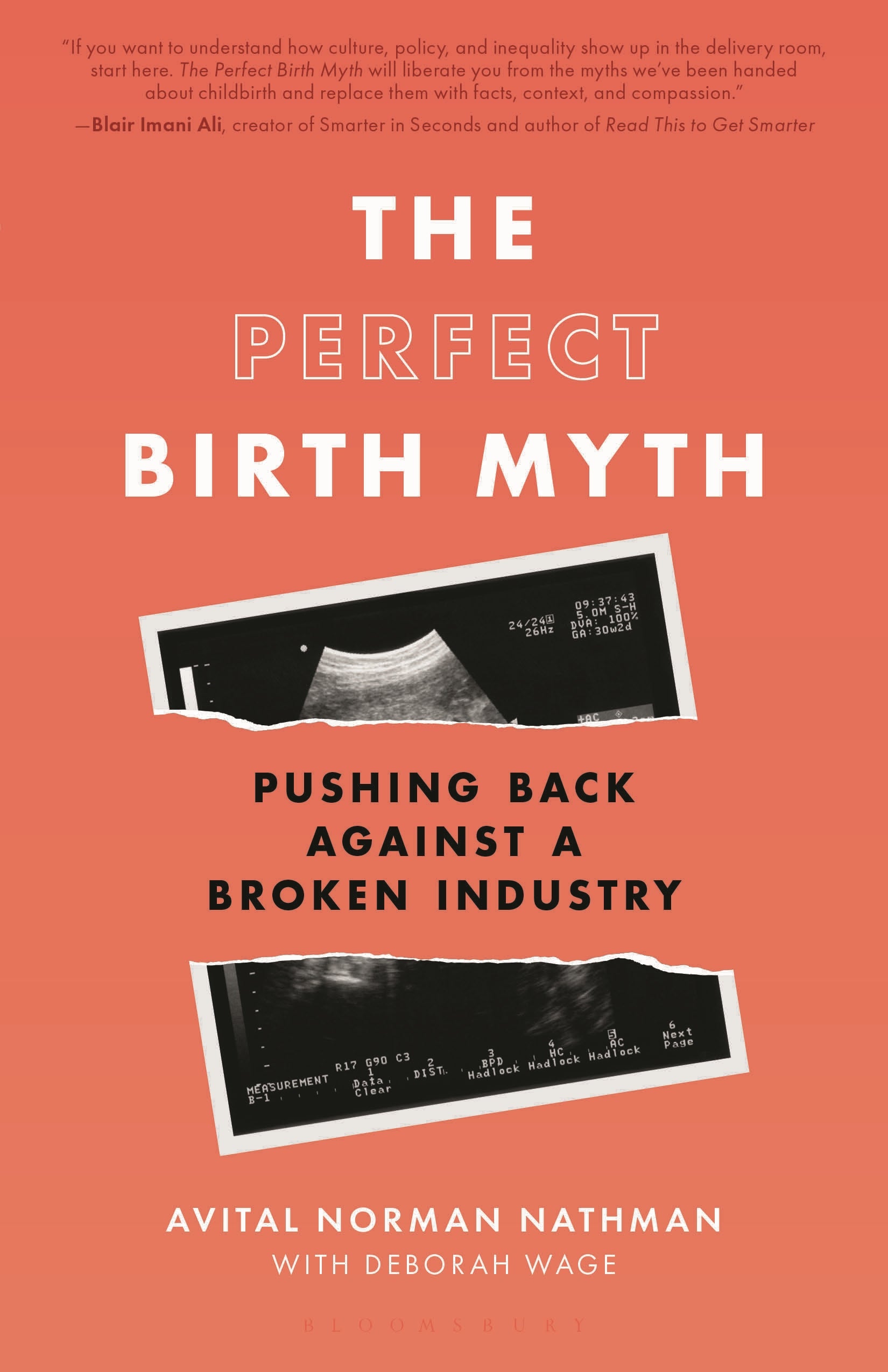 Perfect Birth Myth